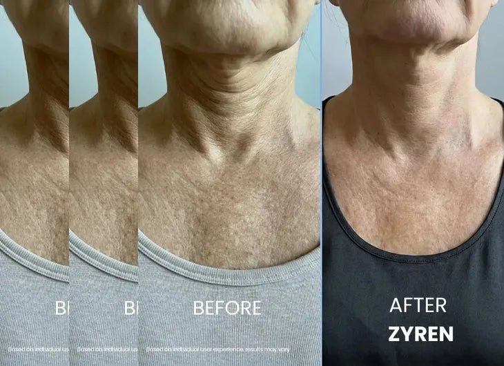 Zyren® Tighten & Lift Neck Cream